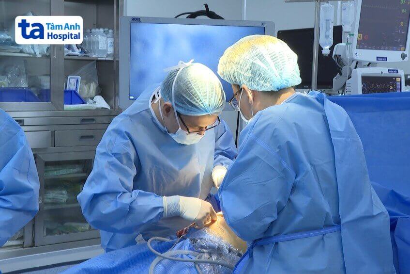 mổ thu nhỏ dạ dày