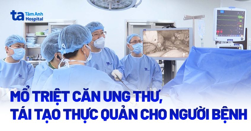 Mổ triệt căn ung thư, tái tạo thực quản cho người bệnh