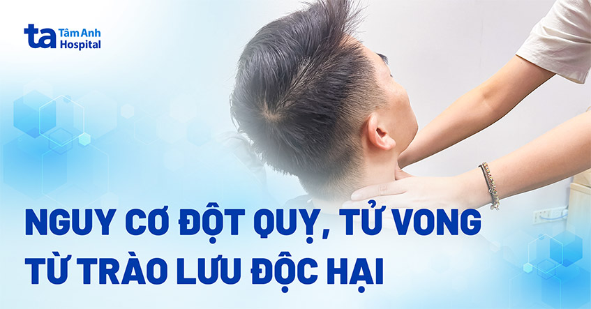 Mối nguy đột quỵ từ trò chơi “bắt pen”