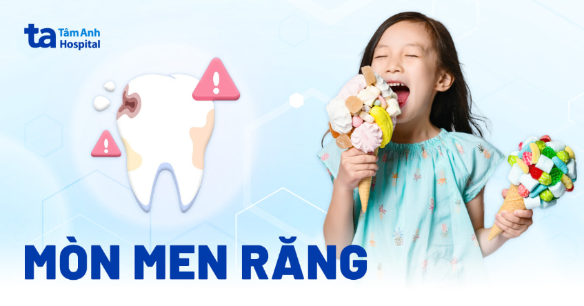 Mòn men răng: Nguyên nhân, dấu hiệu, cách phục hồi và bảo vệ