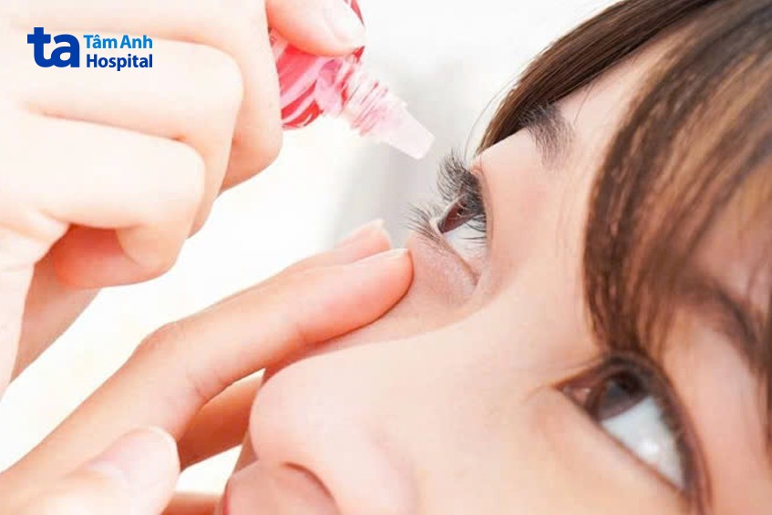 nên thường xuyên nhỏ mắt