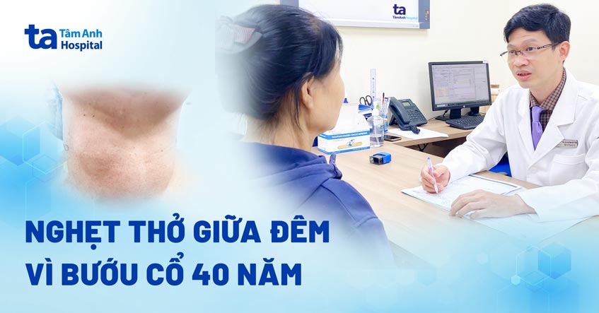 Nghẹt thở giữa đêm vì bướu cổ 40 năm “tuổi”