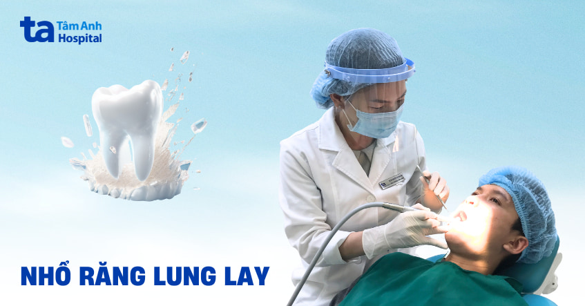 Nhổ răng lung lay có nên không? Cách nhổ không đau như thế nào?