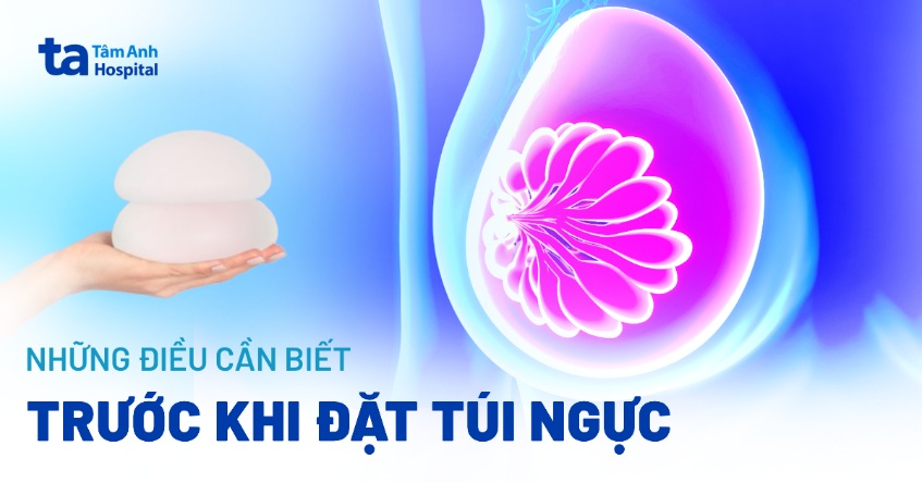 Những điều cần biết trước khi đặt túi ngực và lưu ý quan trọng