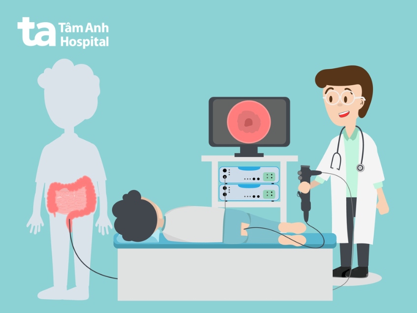 nội soi tầm soát ung thư trực tràng di căn