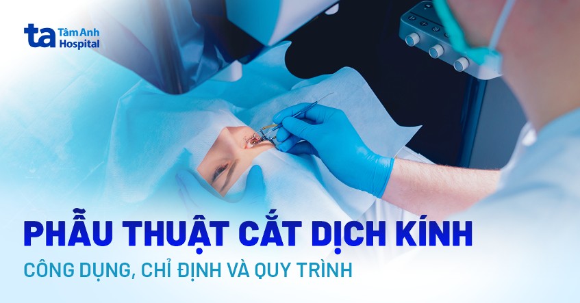 Phẫu thuật cắt dịch kính: Công dụng, chỉ định và quy trình