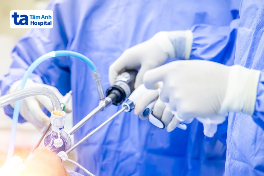 quy trình thắt giãn tĩnh mạch thực quản