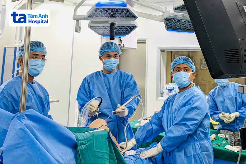 Quy trình thực hiện ghép gần