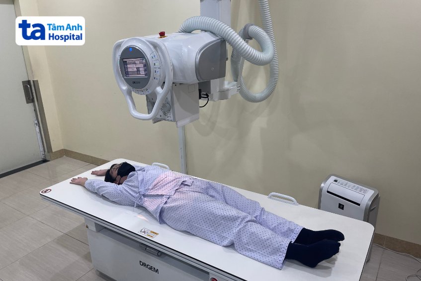 quy trình X quang xương cụt thẳng