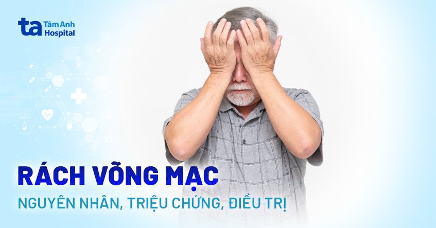 rách võng mạc