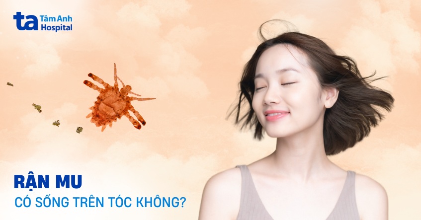 Rận mu có sống trên tóc không? Dấu hiệu nhận biết như thế nào?