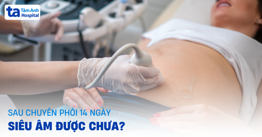 Sau chuyển phôi 14 ngày siêu âm được chưa? Bác sĩ IVF giải đáp