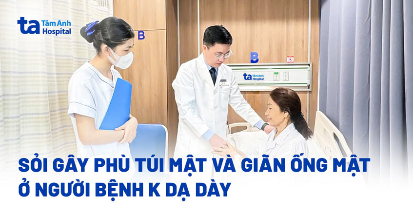 Sỏi gây phù túi mật và giãn ống mật ở người bệnh K dạ dày