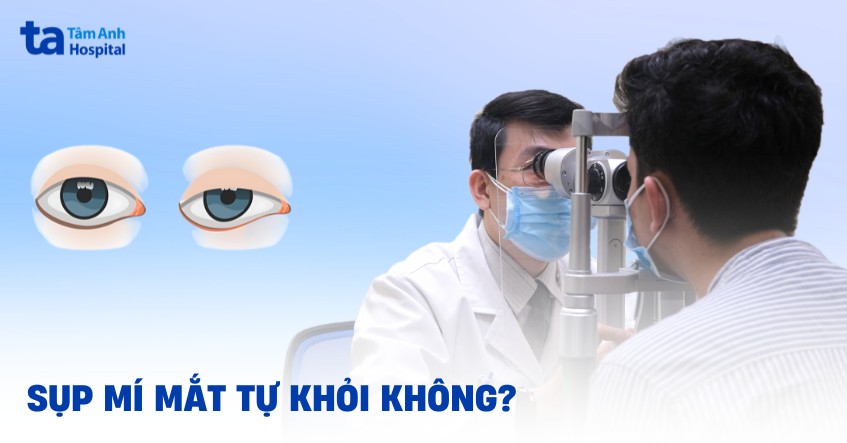 Sụp mí mắt có tự khỏi không? Có nguy hiểm đến sức khỏe không?