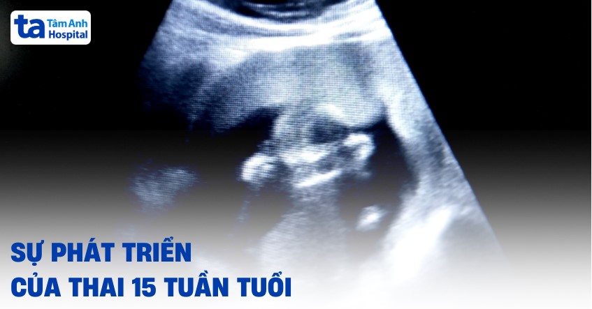 Thai 15 tuần tuổi phát triển như thế nào? Kích thước bằng quả gì?