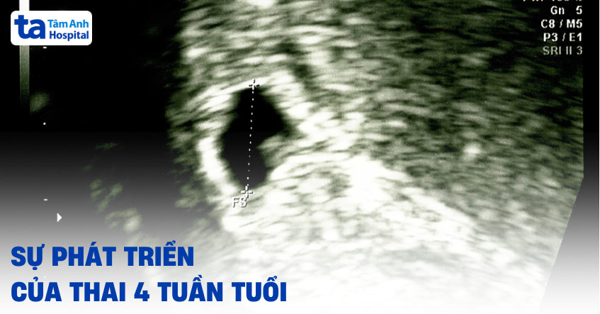 Sự phát triển của thai 4 tuần tuổi: Kích thước thai bao nhiêu?