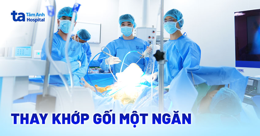 Thay khớp một ngăn cho bệnh nhân thoái hóa khớp gối