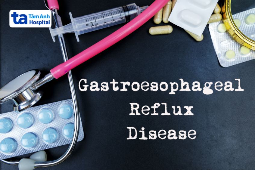 Thuốc là phương pháp được ưu tiên sử dụng