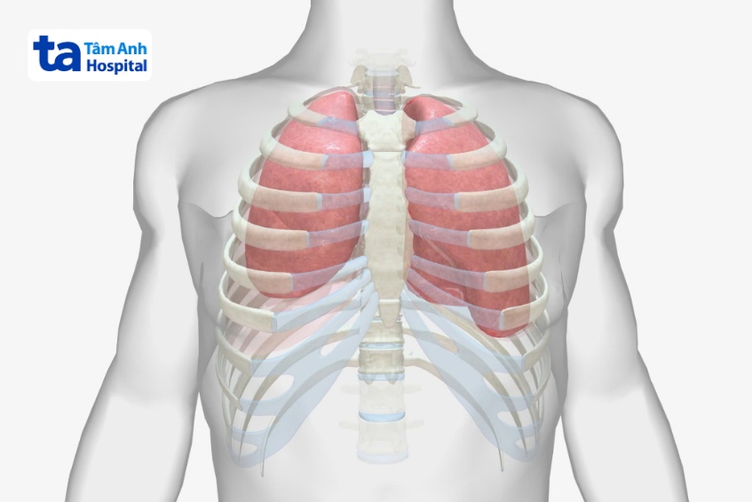 Tràn mủ màng phổi không điều trị kịp thời sẽ dẫn đến xẹp phổi