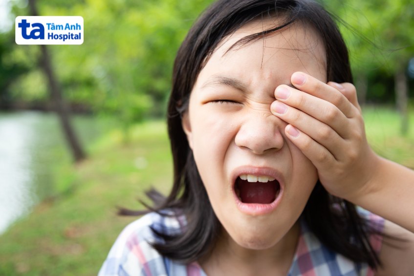 Trẻ có thể bị viêm giác mạc do nhiễm nhiễm trùng