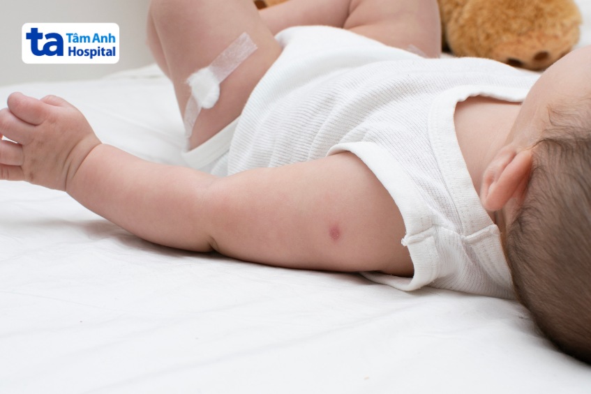 trẻ sau tiêm vắc xin synflorix cần theo dõi