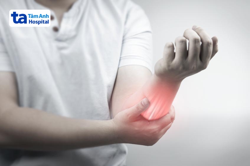 Viêm cơ hoại tử qua trung gian đặc hiệu với triệu chứng yếu cơ