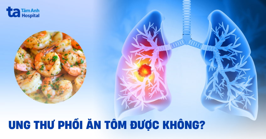 Ung thư phổi có ăn được tôm không và cần lưu ý những gì?