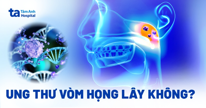 Ung thư vòm họng có lây không? Bệnh có thể lây qua đường nào?