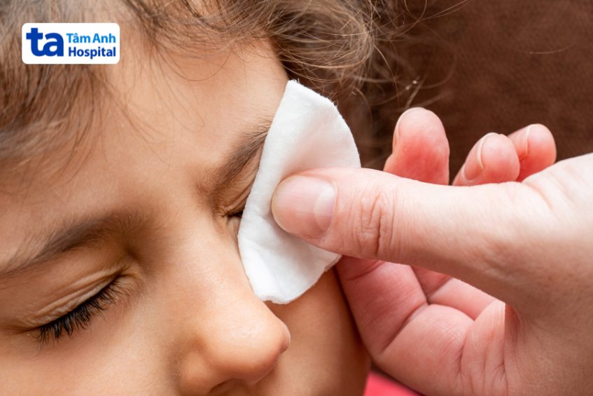 Vệ sinh mắt đúng cách góp phần đẩy lùi bệnh đau mắt đỏ