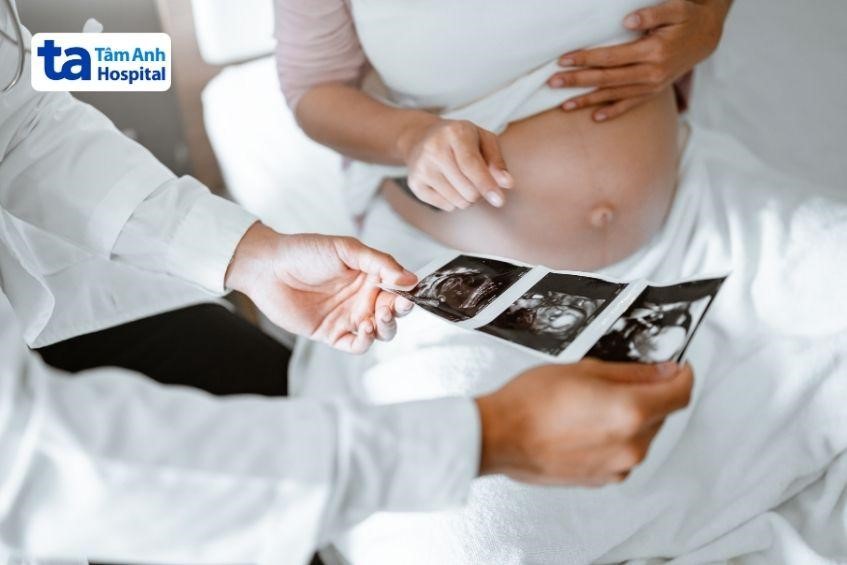 Vì sao cần chọc  ối?