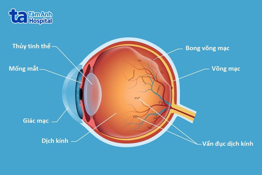 vị trí và các lớp võng mạc
