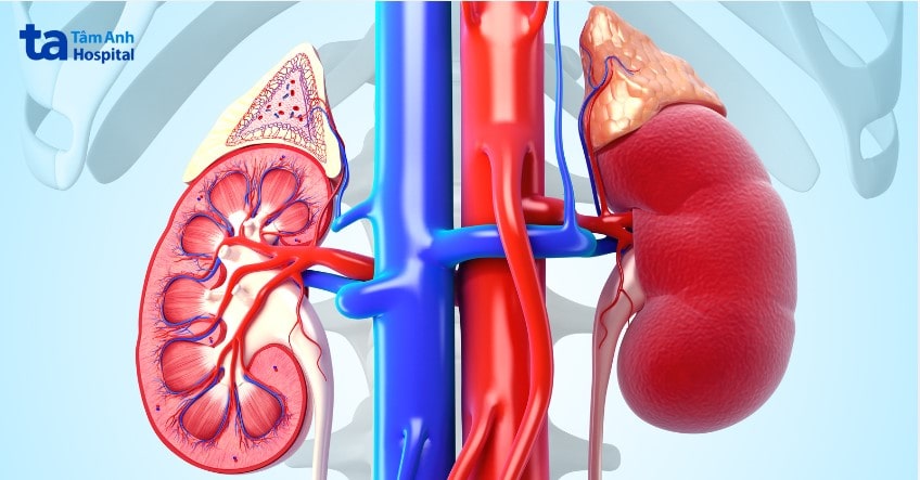 Viêm cầu thận do phức hợp miễn dịch