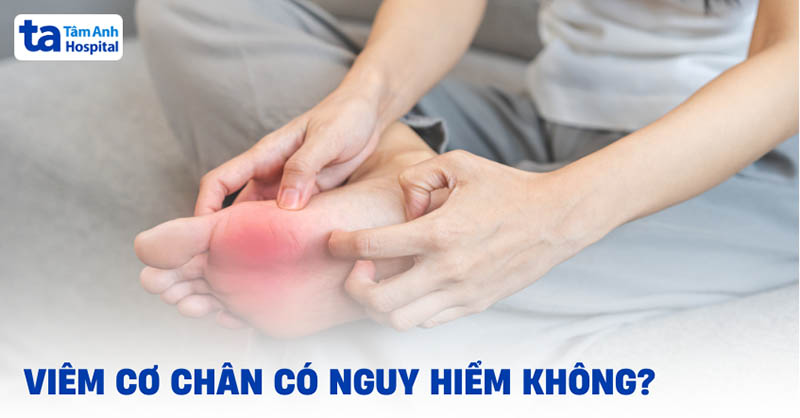 Viêm cơ chân có nguy hiểm không
