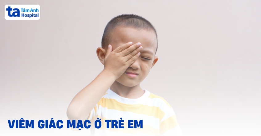 Viêm giác mạc ở trẻ em: Nguyên nhân, triệu chứng và cách điều trị