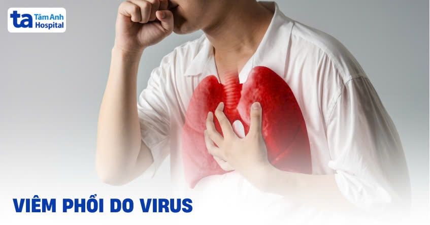 Viêm phổi do virus: Triệu chứng, chẩn đoán và cách điều trị