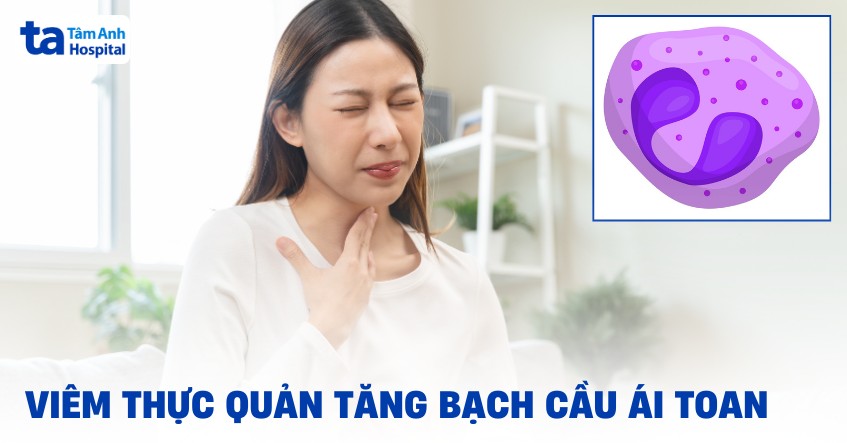 Viêm thực quản tăng bạch cầu ái toan: Nguyên nhân và điều trị