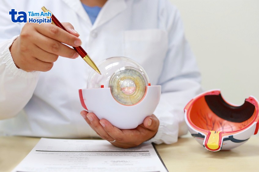 võng mạc nằm trong cùng thành nhãn cầu