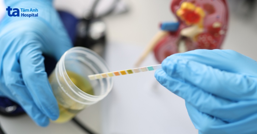 xét nghiệm chức năng thận bao nhiêu tiền