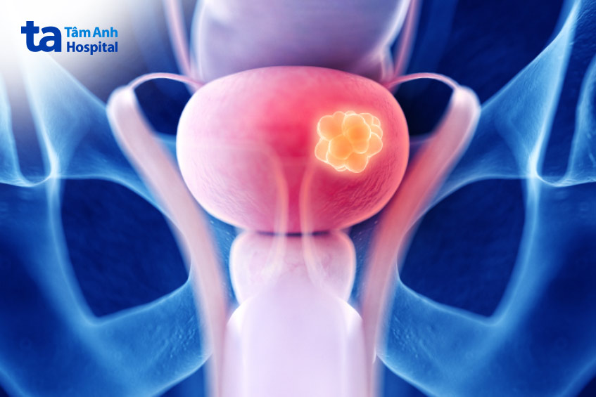 xét nghiệm để kiểm tra bên trong niệu đạo và bàng quang