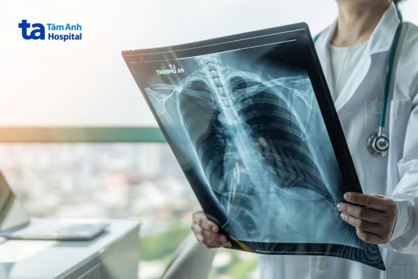 Xét nghiệm hình ảnh chẩn đoán viêm phế quản cấp