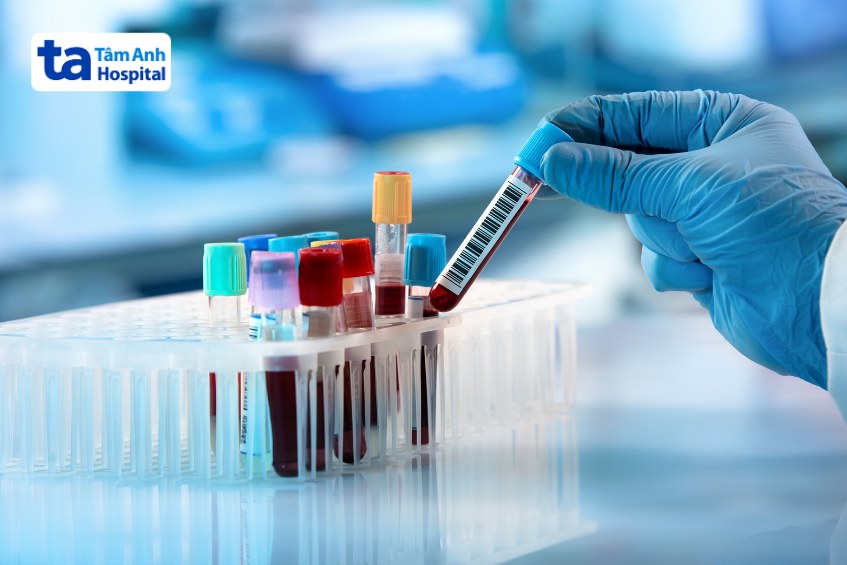 xét nghiệm huyết thanh chẩn đoán nhiễm cmv