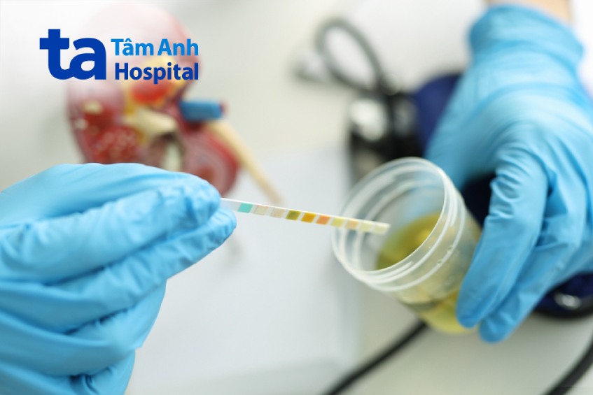 xét nghiệm nước tiểu phát hiện bất thường