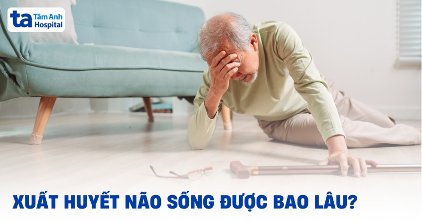 Xuất huyết não sống được bao lâu? Tiên lượng bệnh như thế nào?