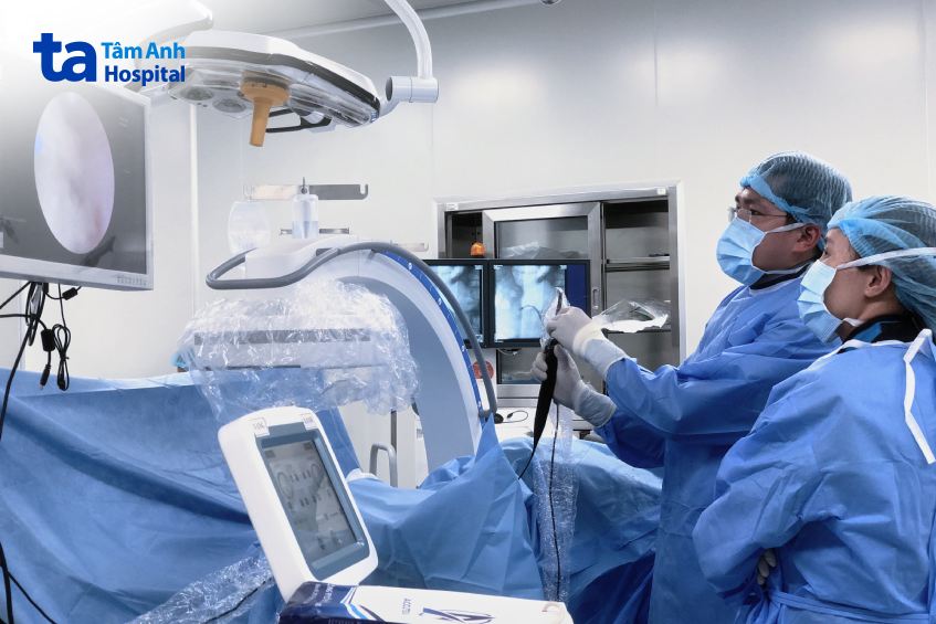 bác sĩ đang nội soi tán sỏi ngược dòng bằng ống mềm