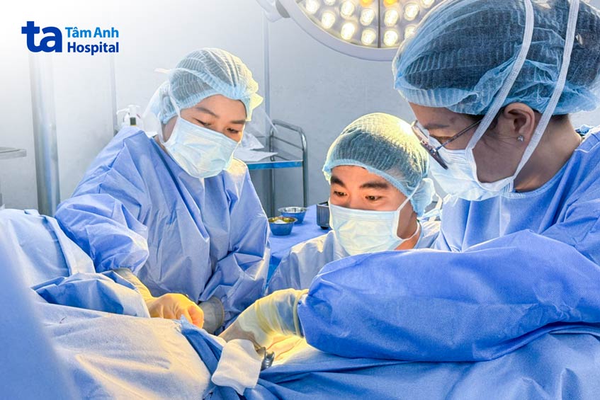 bác sĩ đang phẫu thuật cắt khối u