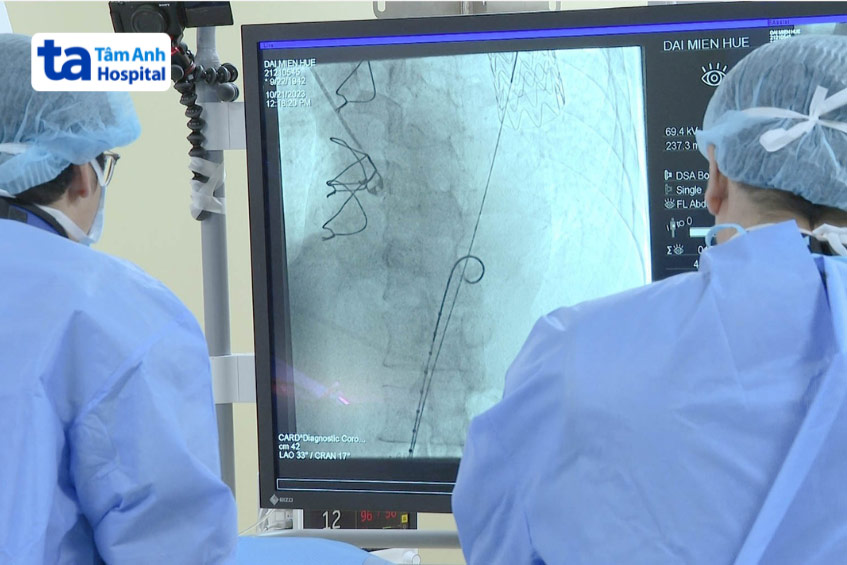 Bác sĩ thực hiện thủ thuật đặt stent mạch vành