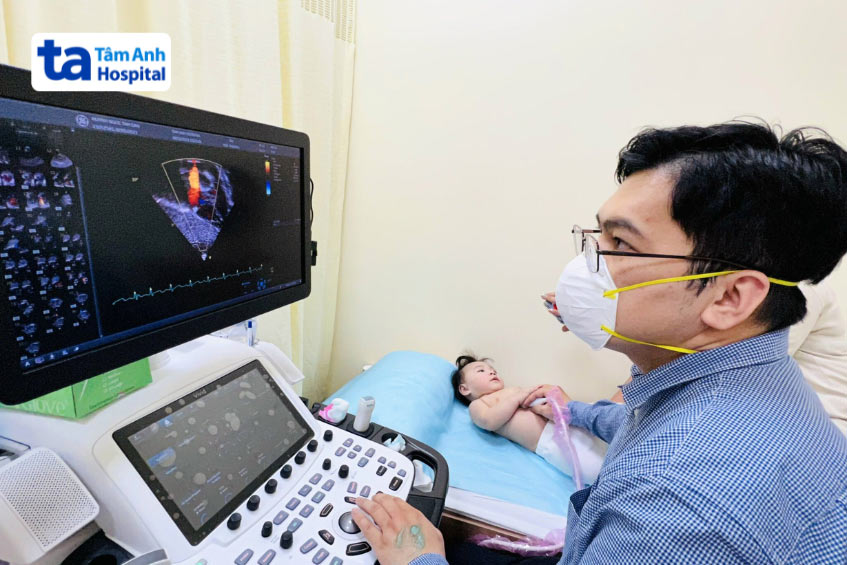 BS.CKI Vũ Năng Phúc thực hiện siêu âm tim cho trẻ sơ sinh tại BVĐK Tâm Anh TP.HCM