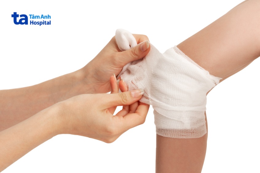 Băng vết thương bỏng cho trẻ đúng cách