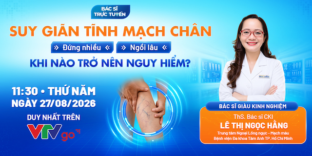 banner suy giãn tĩnh mạch chân khi nào trở nên nguy hiểm