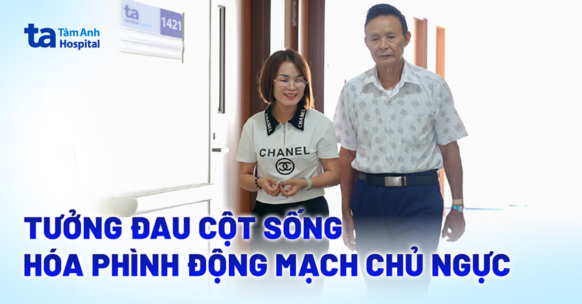 Tưởng đau cột sống hóa phình động mạch chủ ngực